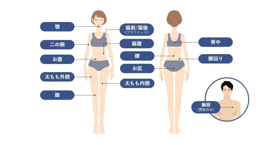 CoolSlimming＜クールスリミング＞ 適応可能な部位